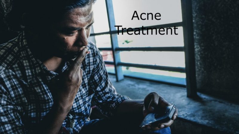 Raleigh Acupuncture Acne Treatment Delivers Best Results