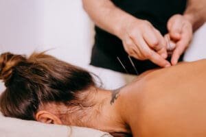 Raleigh Acupuncture Answers Does Acupuncture Work